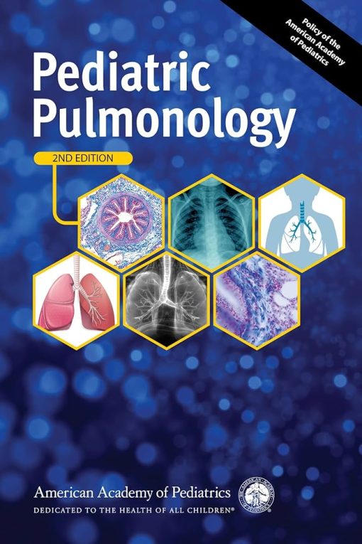 Pediatric Pulmonology, 2e